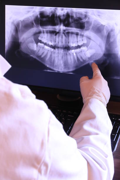 Best Emergency Tooth Extraction in Mission, SD